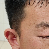后怕！楚雄一男子钓鱼钓到进急诊，消防出动1车6人前往救援...