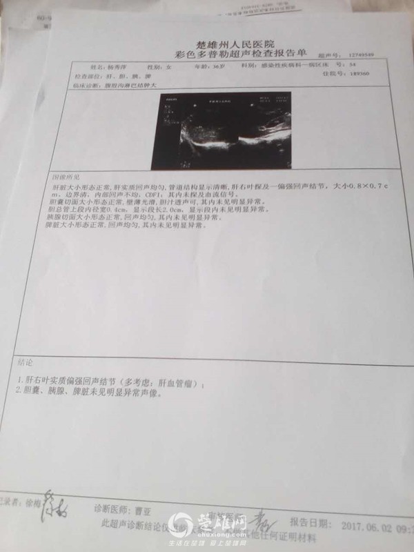 QQ图片20170628175229.jpg