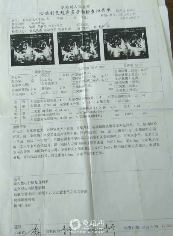 QQ图片20170818112032.png